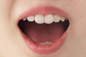 船橋でリンパ浮腫を根本改善!評判の整体院と効果的な対策法を徹底解説